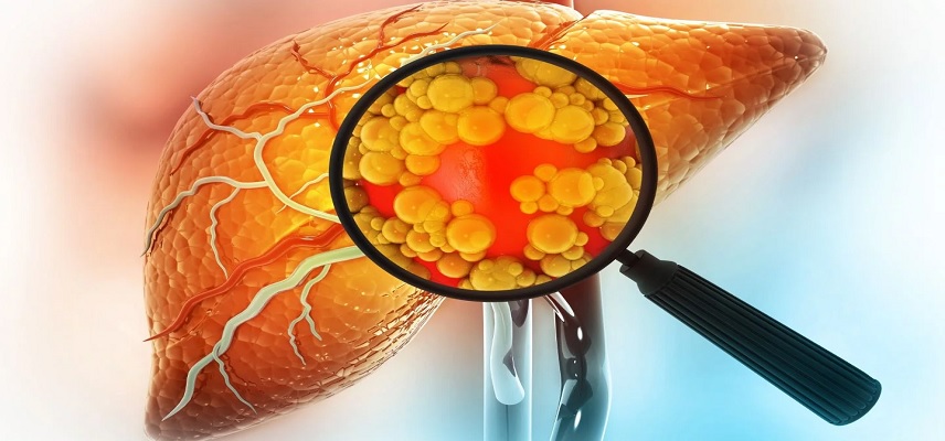 Evotec SE and Variant Bio Collaborate for Diseases Caused by Fibrosis